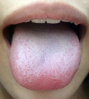 为了你和家人的健康你必须懂得看面色和舌苔