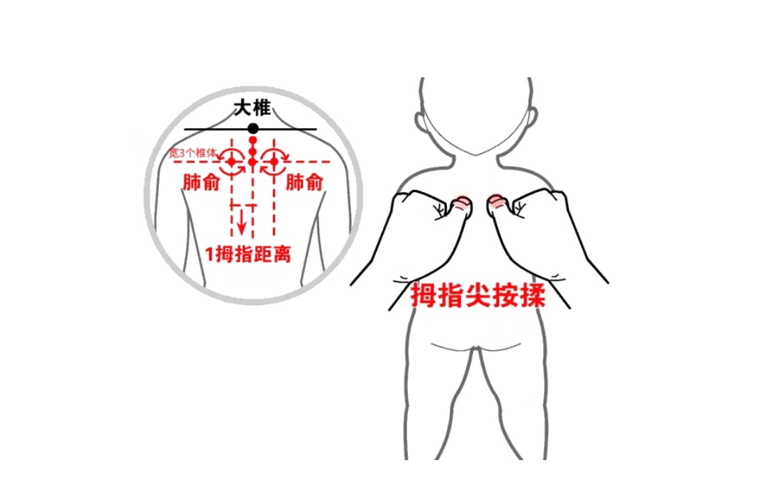 94肺俞【位置】在第三胸椎棘突下,即身柱穴旁开1.5寸.足太阳膀胱经.