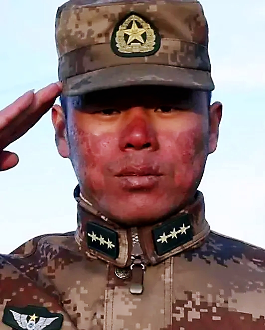 所有的防护都不是那么有效 边防战士们说:"脸上太疼了 洗脸都不敢用手