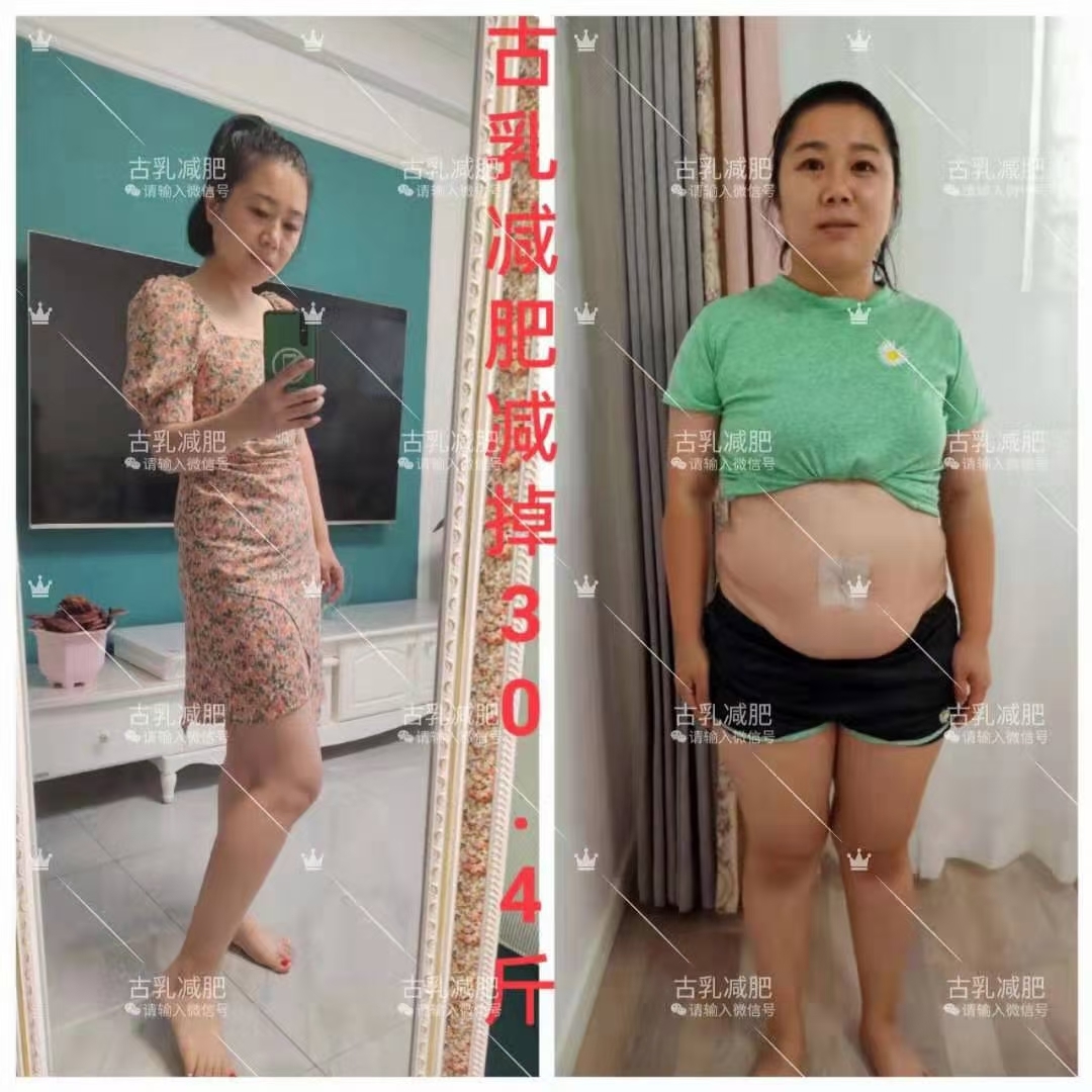 古乳金箔百草丽秀套减肥有效果吗使用案例