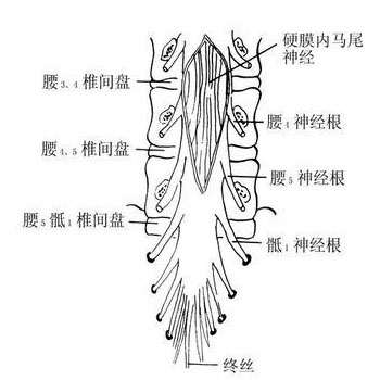 自我诊断颈腰椎病