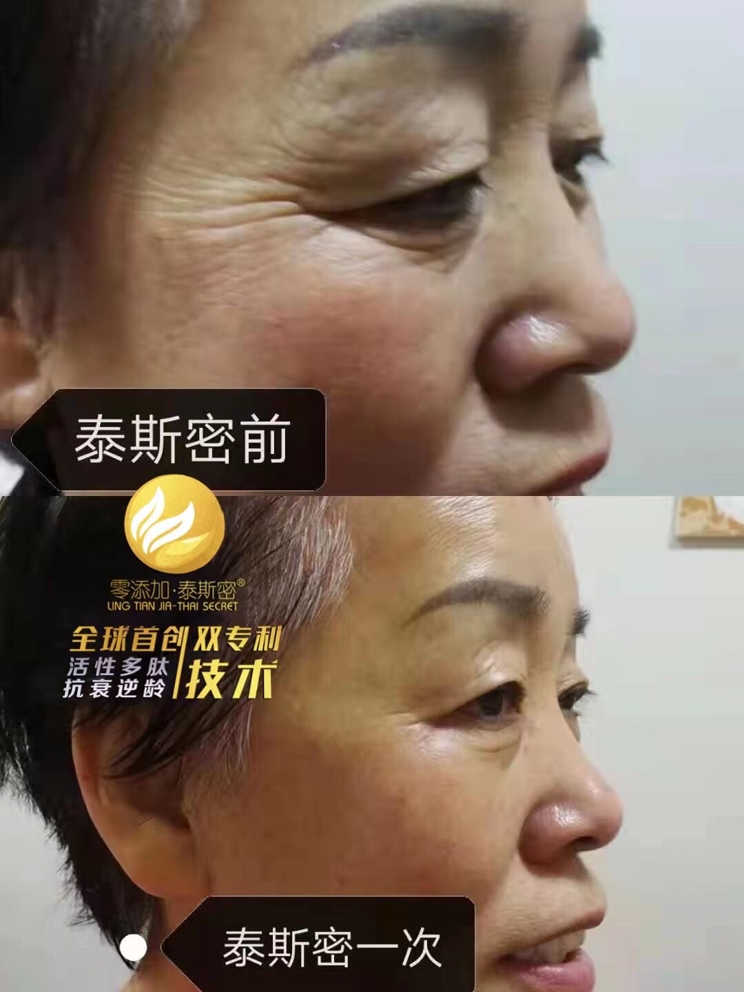 泰斯密效果怎么样泰斯密抗衰面膜
