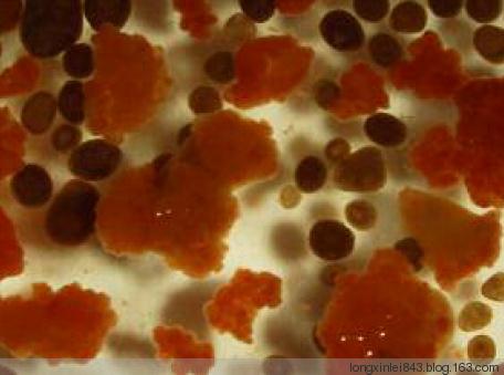 厌氧氨氧化看来真不那么简单