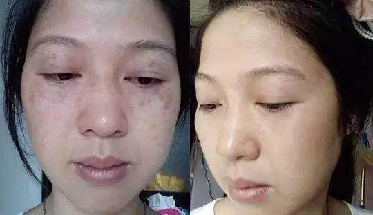 农村满地都是的它是斑点杀手,祛斑强过激光十倍,半月皮肤更水润