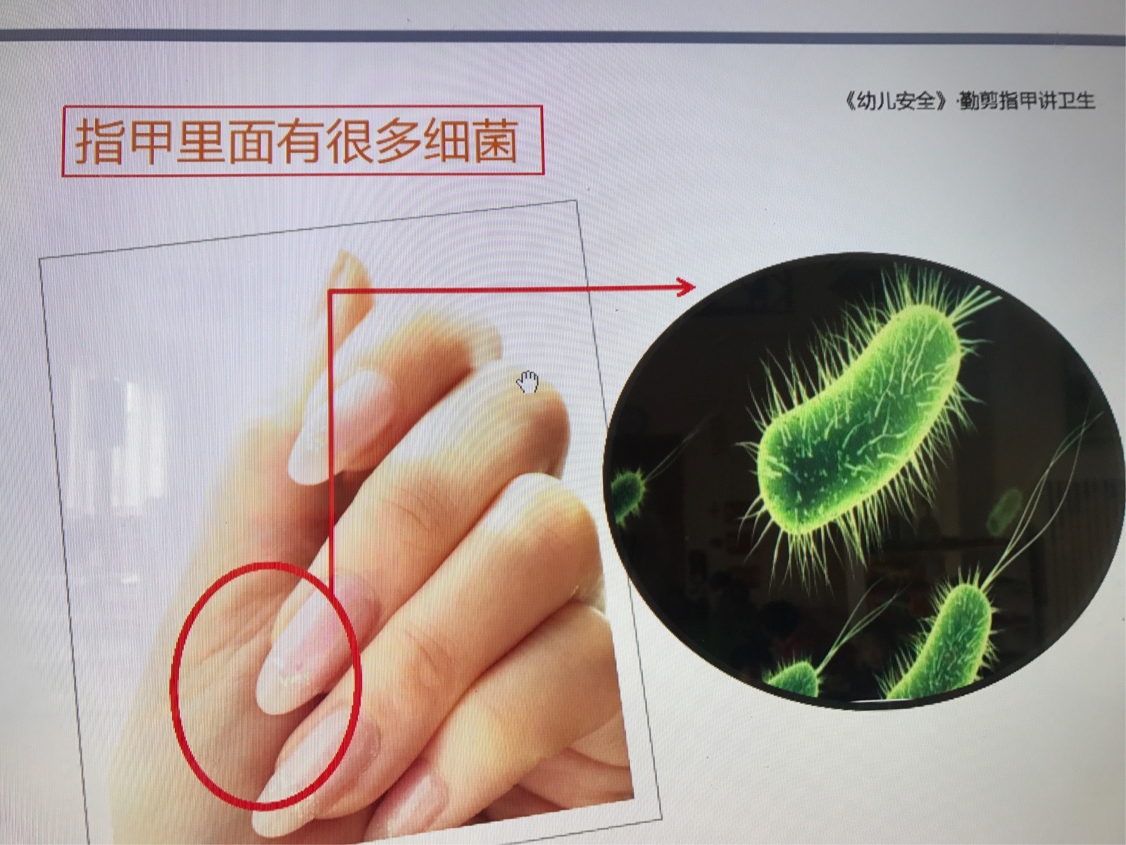 手指上的细菌图片