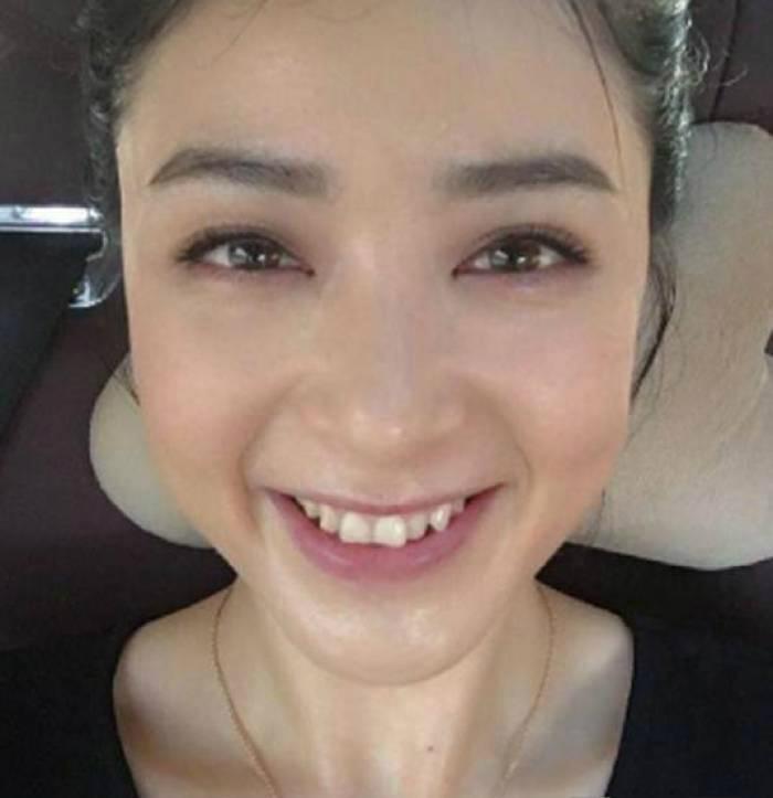 李沁的大黄牙变白了牙齿不怕变黄了